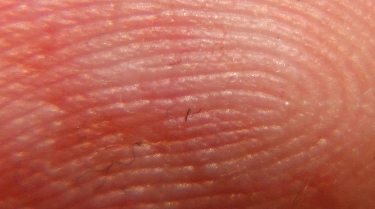 kleiner Finger